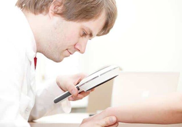 Diagnostika psoriázy dermatologem