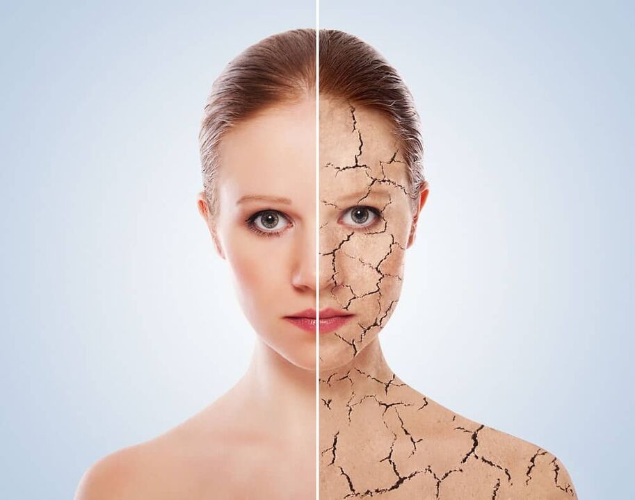 Zdravá kůže a kůže postižená psoriázou